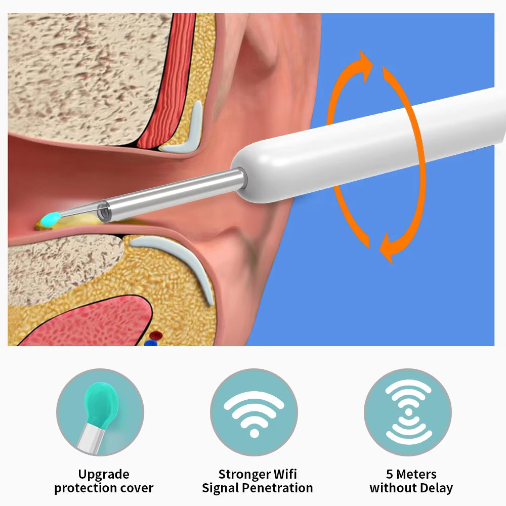 Earwax Removal Tool High Precision Ear Cleaner with Camera LED Light Otoscope with 8 Pcs Ear Set Endoscope for Iphone Best Gift